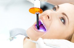 dentist using curing light to harden dental bonding