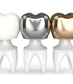 three dental crowns