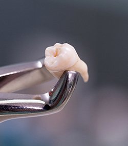 Close up of forceps holding extracted tooth