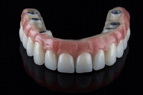 Implant denture for upper arch against black background