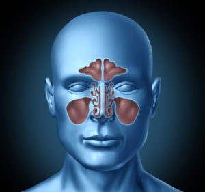 image of the sinuses