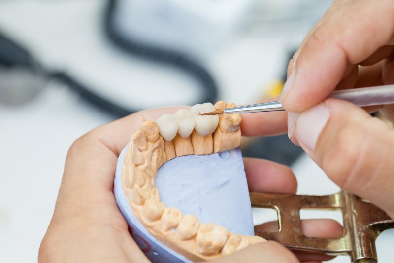 Dentures At 28  : Bakıda Ucuz Traktor T28 Alış Satışı Alıram Yeni 2020 Elanları Traktor T28 Qiyməti Satıram Kreditlə Satılan Traktor T28 Ucuz Tap Az Pulsuz.