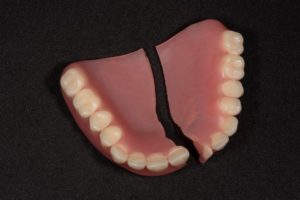 Broken denture in Marshall, in need of repair or replacement