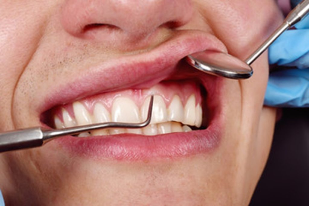 Patient having their gums inspected by their dentist.