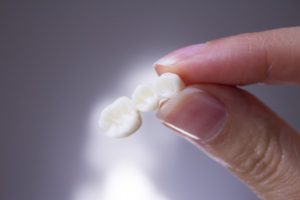 a person holding their dental bridge after it fell out