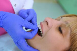 Woman getting porcelain veneers placed